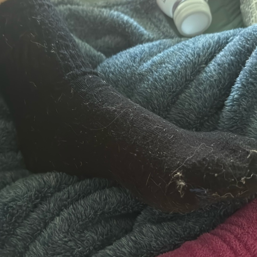 Taco munchers unwashed stinky socks (comes with the feet)